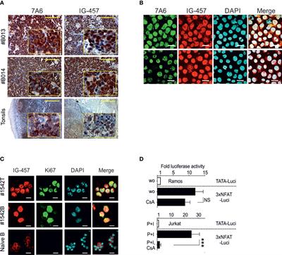 Calcineurin-independent NFATc1 signaling is essential for survival of Burkitt lymphoma cells